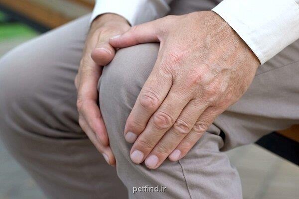 افزایش 13 درصدی مبتلایان به آرتریت روماتوئید