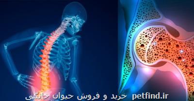 پوكی استخوان در زنان بیشتر از مردان